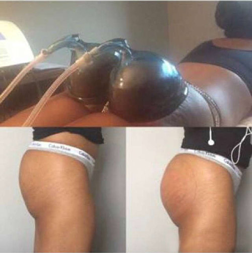 翘臀神器，男人，女人都值得拥有